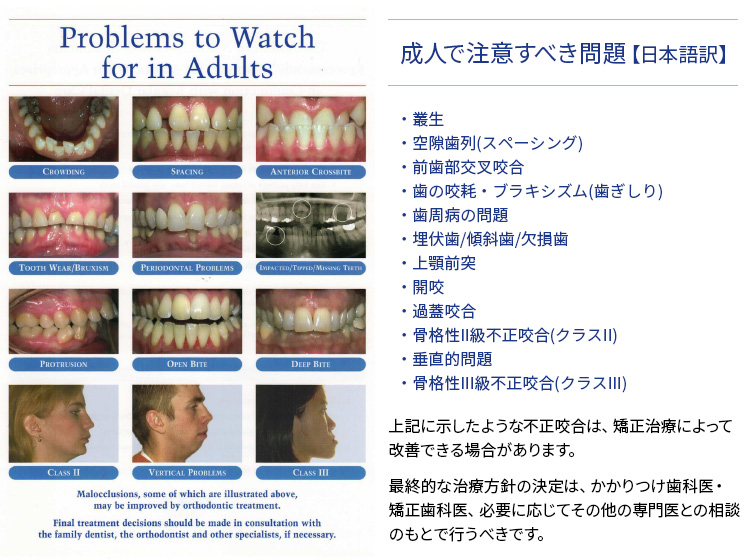 アメリカ矯正歯科学会（AAO : American Association of Orthodontists）発行リーフレット